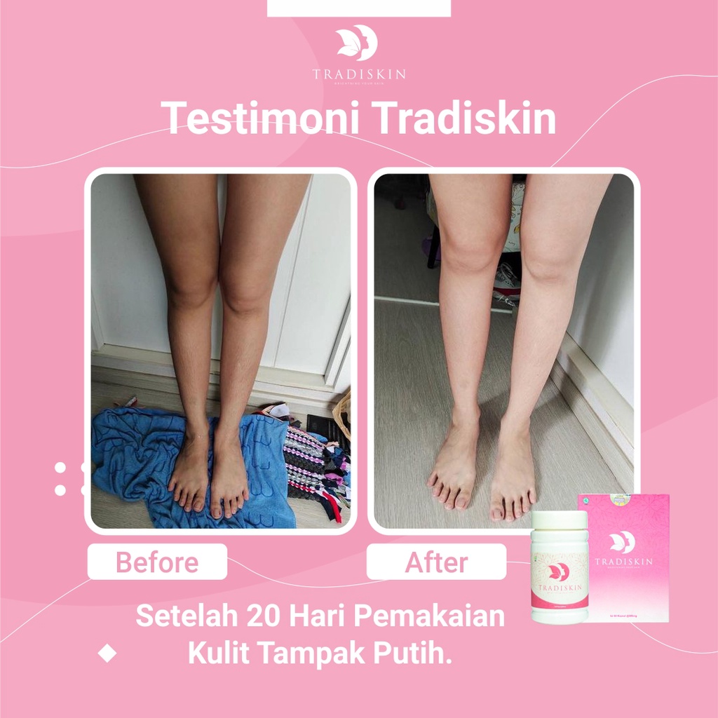 TRADISKIN Pemutih Pencerah Kulit Badan Herbal Alami ORIGINAL BPOOM