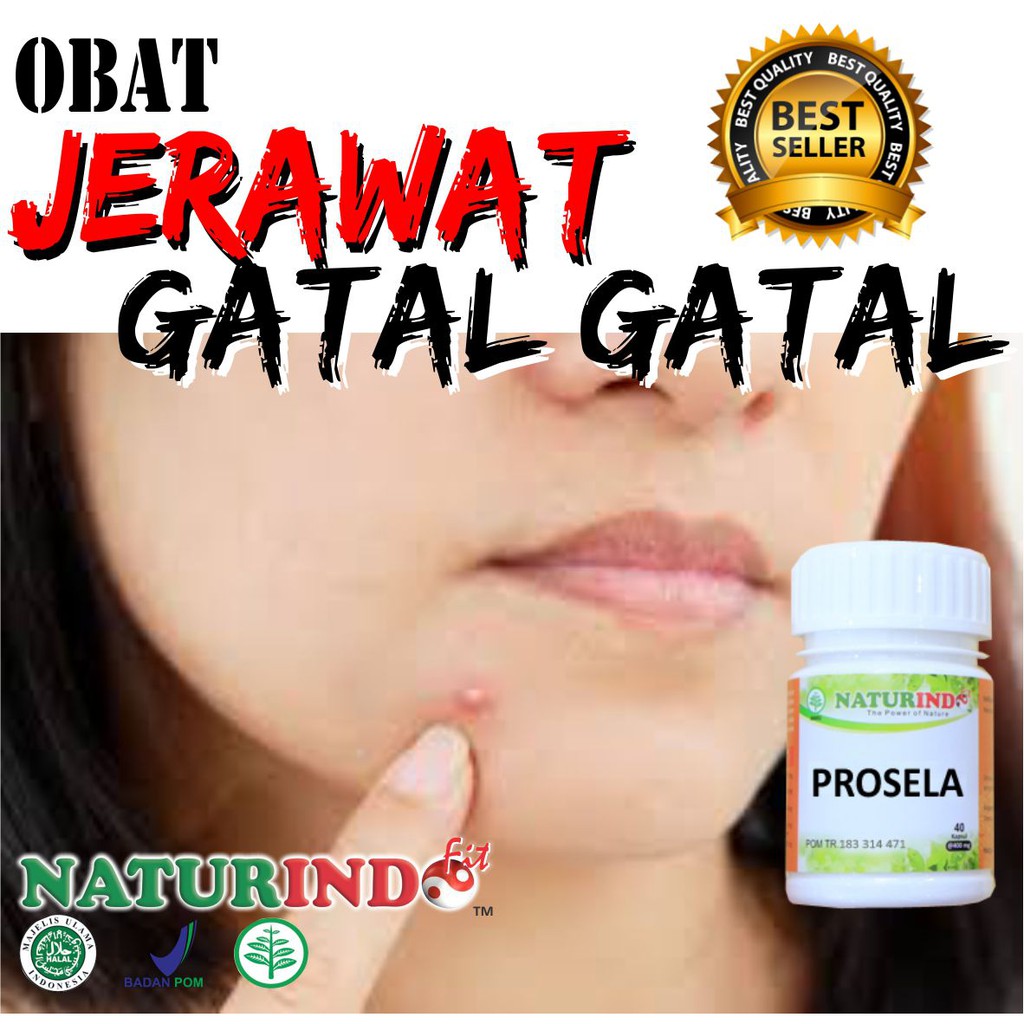 Obat Jerawat dan Bekas Jerawat Obat Jerawat Paling Ampuh Obat Jerawat Punggung Obat Jerawat Pria