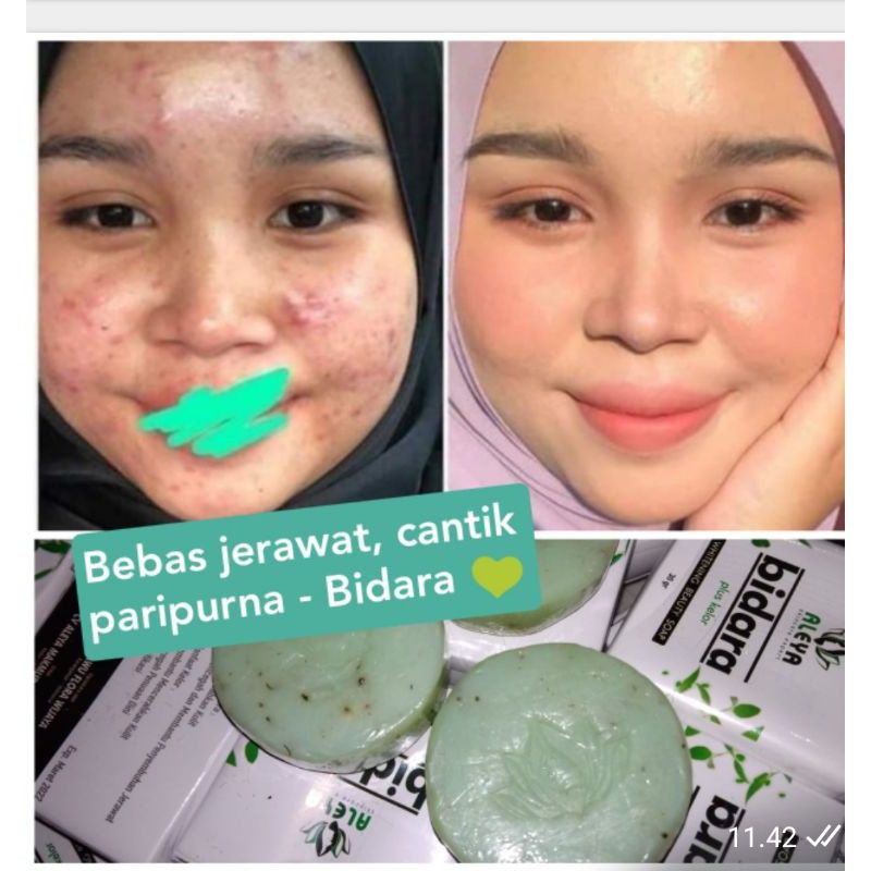 Sabun Bidara Kelor Aleya Pemutih Wajah Sabun Whitening Sabun Glowing Face
