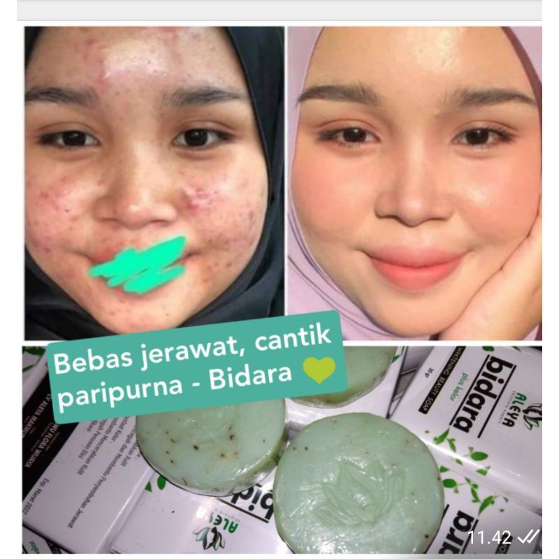 Sabun Bidara Kelor Aleya Pemutih Wajah Sabun Whitening Sabun Glowing Face