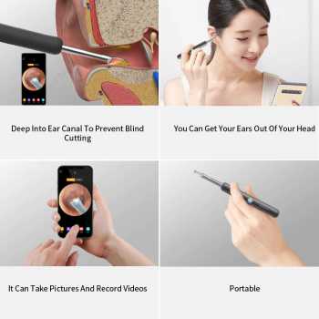 Korek Kuping Stick Kamera Endoscope Pembersih Telinga Smart Visual Ear Pick 300W