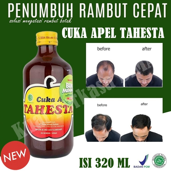 BARU Obat penumbuh rambut cepat panjang memperbaiki rambut rusak CUKA APEL TAHESTA isi 320 ml BPOM