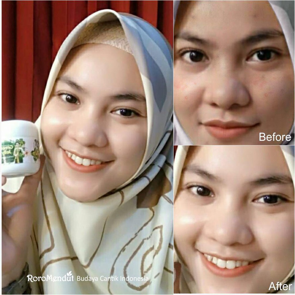 Roro Mendut Green Jelly Sleeping Mask Whitening + Anti Acne Jerawat 15 gr Super Glowing Premium