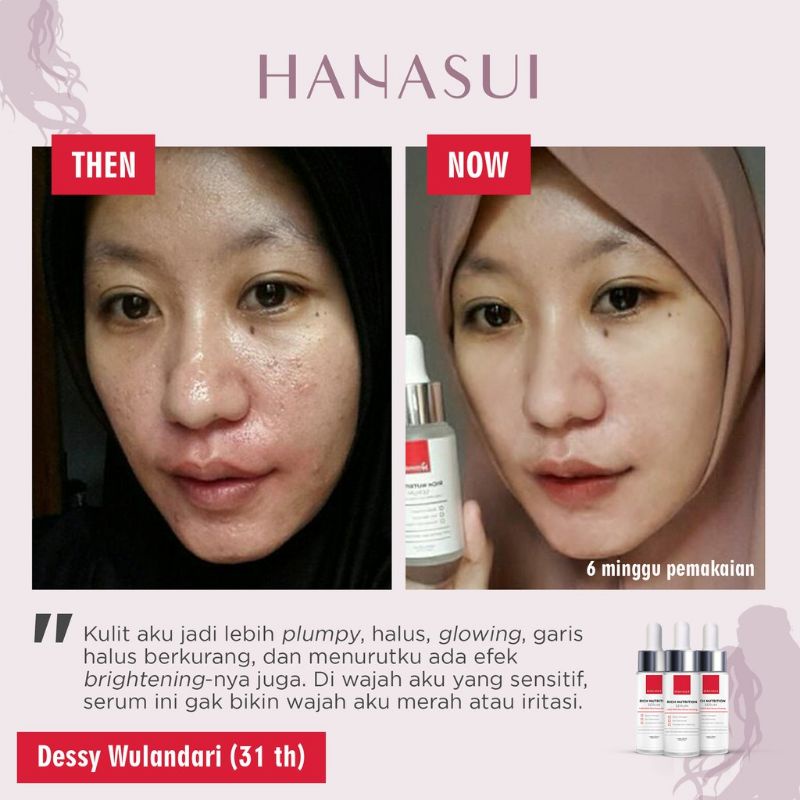 hanasui instens treatment serum - serum hanasui intens treatment - serum hanasui rich - serum hanasui propolis - serum hanasui bright up - Hanasui serum intens treatment - serum hanasui treatment serum - serum intens hanasui