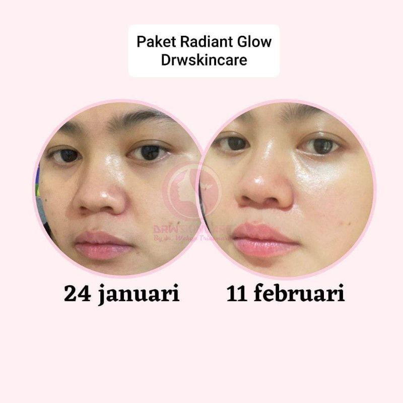 PAKET GLOWING RADIANT GLOW DRWSKINCARE/WAJAH GLOWING KRIM GLOWING DRW SKINCARE