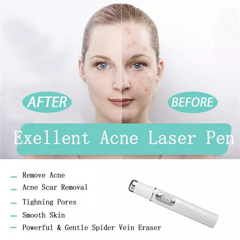 Acne Laser Pen Facial Massager Treatment Soft Scar