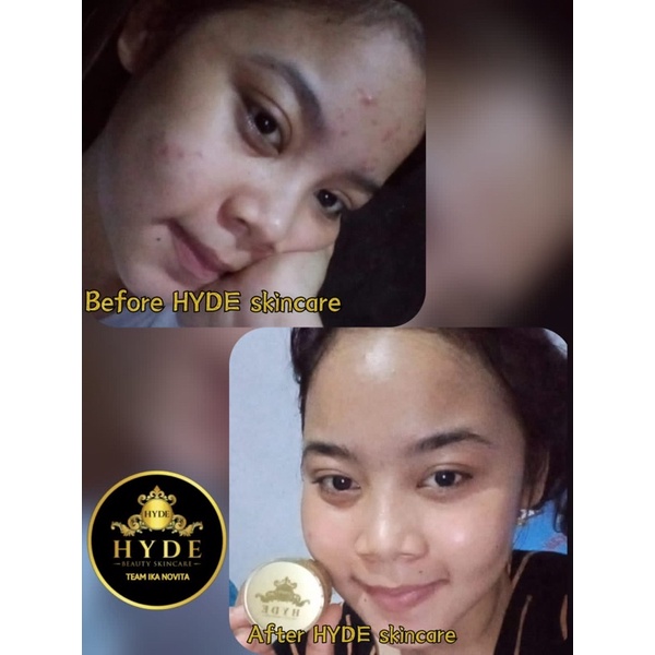 Hyde Beauty Skincare Paket Glowing isi 4 Toner