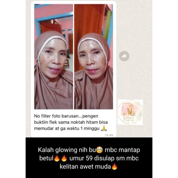 Mbc skincare DNA/pemutih wajah produk ori 100%