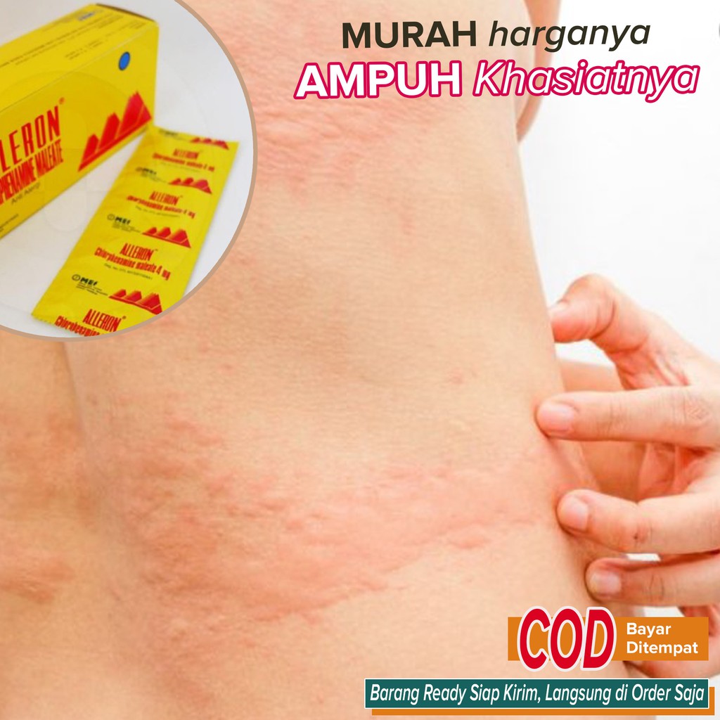 Obat gatal Kulit Biduran AMPUH murah ~ alleron tab
