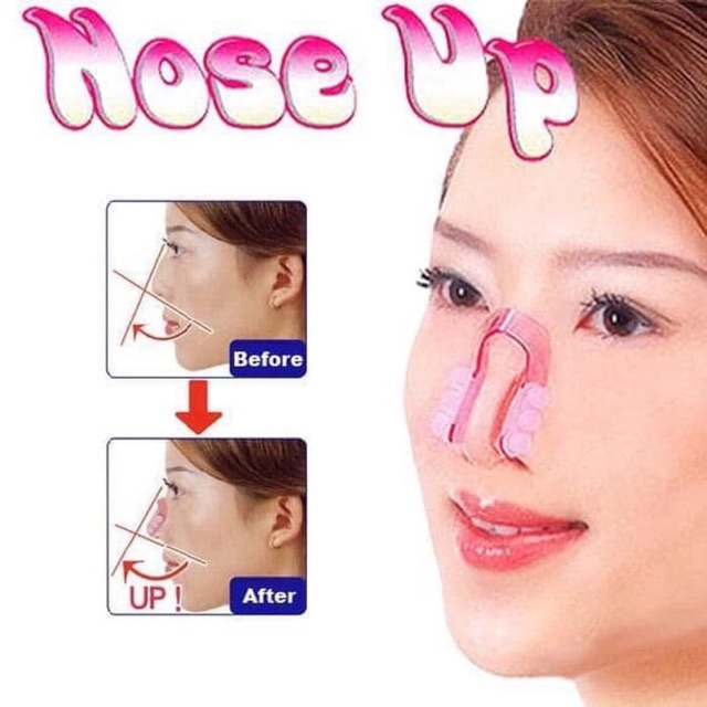 NOSE UP CLIPER / ALAT PEMANCUNG HIDUNG ORIGINAL