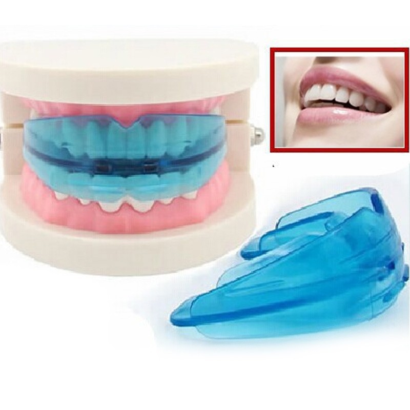 Alat perapi gigi / behel merapikan gigi / teeth dewasa
