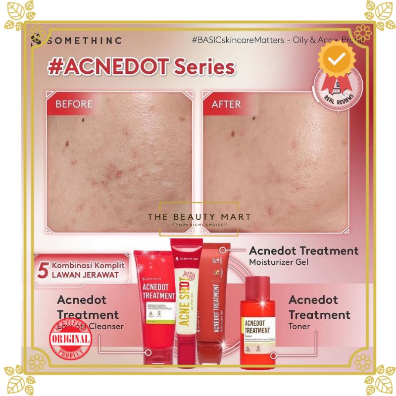 Somethinc Acnedot Treatment Series | Acnedot Treatment Moisturizer Gel | Toner | Low Ph Cleanser