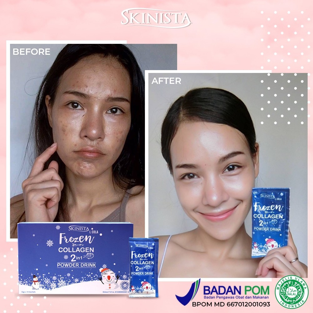 POWDER DRINK FROZEN COLLAGEN 2 IN 1 SKINISTA / MINUMAN COLLAGEN PEMUTIH BPOM