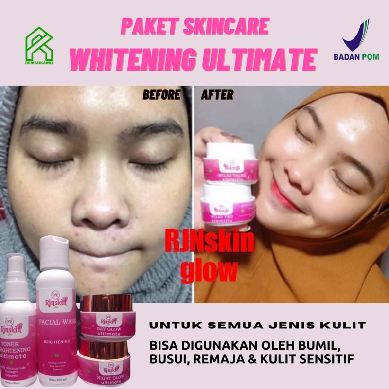NR Glow RJNSKIN Whitening ultimate Paket Skincare Pemutih Wajah Glowing