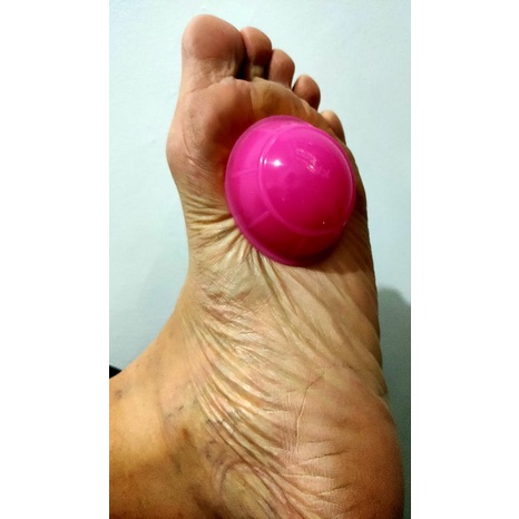 Kop Angin (bekam kering+kerokan) KOP B  ORIGINAL