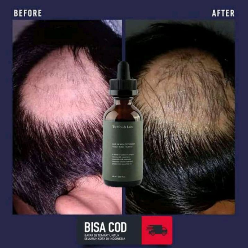 Jual Tumbuh lab hair mist original tumbuh lab (kemasan baru) Indonesia