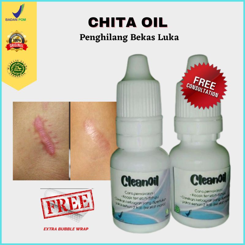Penghilang Bekas Luka Hitam Koreng Bakar BPOM Chita Oil Ampuh Original Alami Dapat Menghilangkan Bek