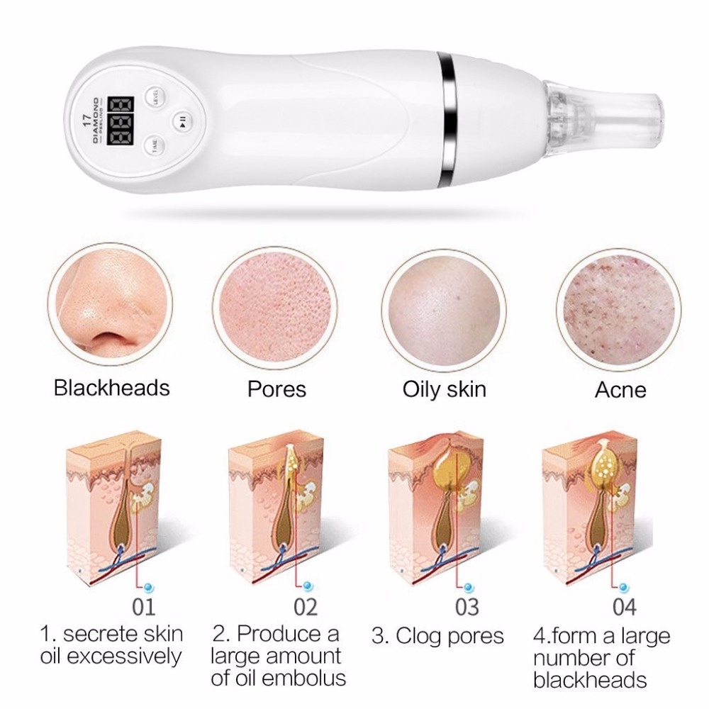 2 in 1 Diamond Peeling Alat Dermabrasi dan Penyedot Komedo - Alat Microdermabrasi Profesional untuk Perawatan Kulit Mulus dan Bersih