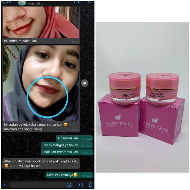 Skincare angel tacik