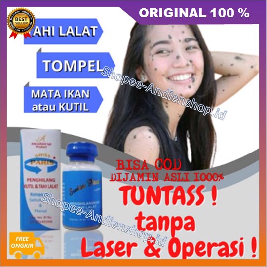 [BISA COD] BELI 2 GRATIS 1 Salep Kutilang Salep Tahi Lalat, Kutil & Daging Tumbuh Ampuh 100% ORIGINA