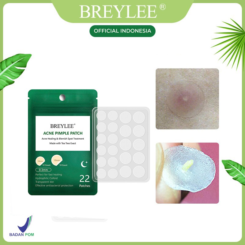 Penghilang Jerawat BREYLEE Acne Pimple Patch Day|Night - Penghilang &amp; Stiker Jerawat 0.1mm|0.3 mm