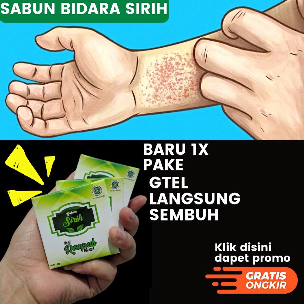 Sabun Gatal Bidara Sirih Obat Kulit Gatel,Eksim,Scabies,Kudis