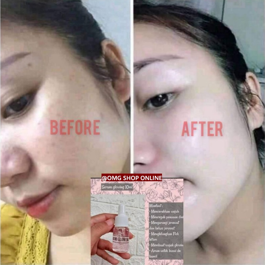 TERMURAH !!! Serum Glowing Viral ORIGINAL 10 ml / Serum Ajaib Glowing dalam 5 Menit Serum Glowing Pemutih 10 ml / Serum Glowing ORI Serum Glowing ORIGINAL / Serum Wajah Glowing Serum Glowing Ampuh Skin / Serum Wajah Pemutih Serum Glowing Pink Original