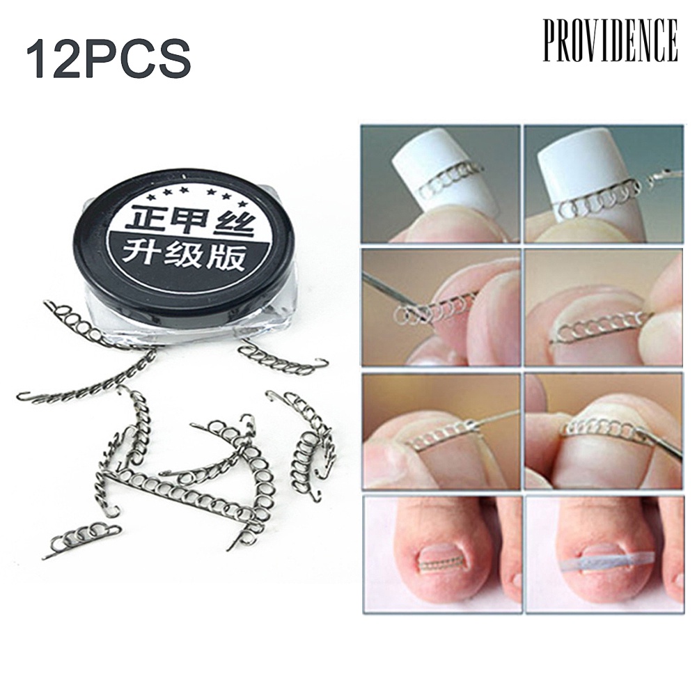 Providence 12Pcs Ingrown Toe Nail Correction Wire Pedicure Toenail Corrector Foot Care Tool