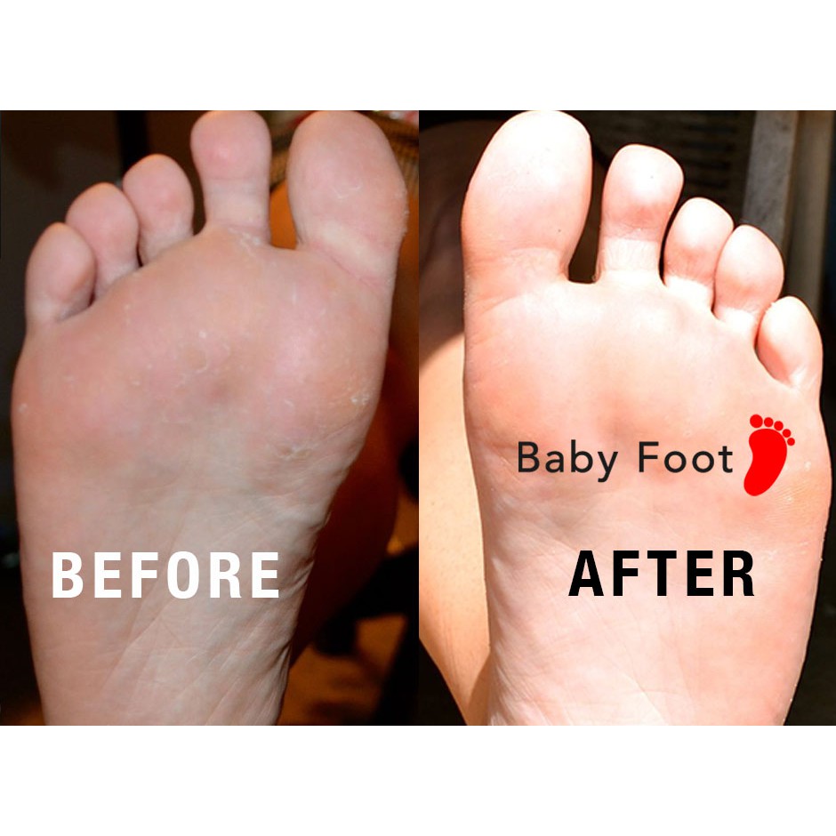 Baby Foot Easy Pack Masker Kaki EXP:July 2024