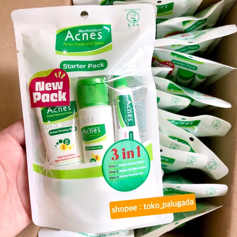 [BISA COD] Acnes Treatment Series Starter Pack - Acnes Starter Pack - Paket Acnes