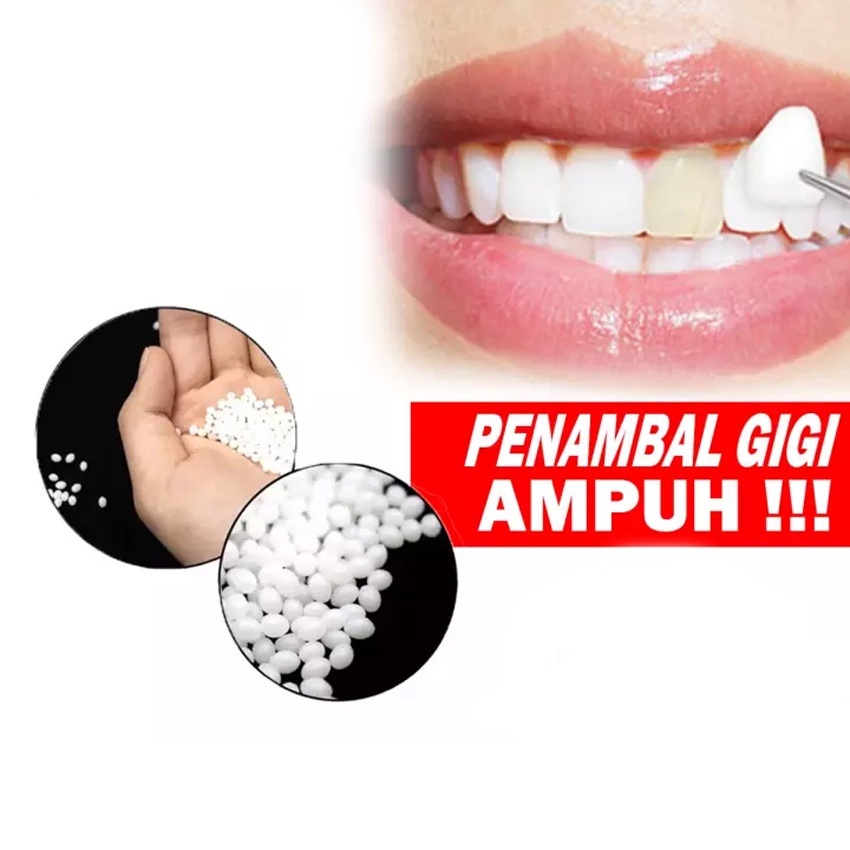 HOPE STORE - [ PROMO 50 BUTIR ] PENAMBAL GIGI OMPONG TEMPTOOTH MURAH / GIGI PALSU PENAMBAL GIGI PATAH RENGGANG