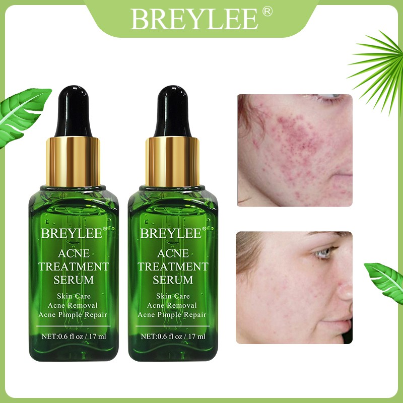 Breylee Serum Esens Natural untuk Menghilangkan Jerawat ...