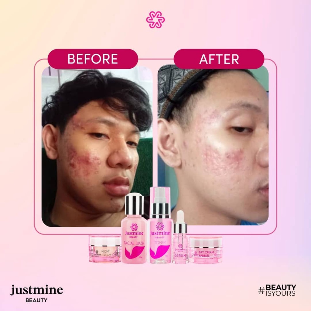 Paket Reguler isi 4 Justmine Beauty Skincare Glowing Acne Jelly Remove Spots Acne More Original BPOM | Paket Cream Wajah