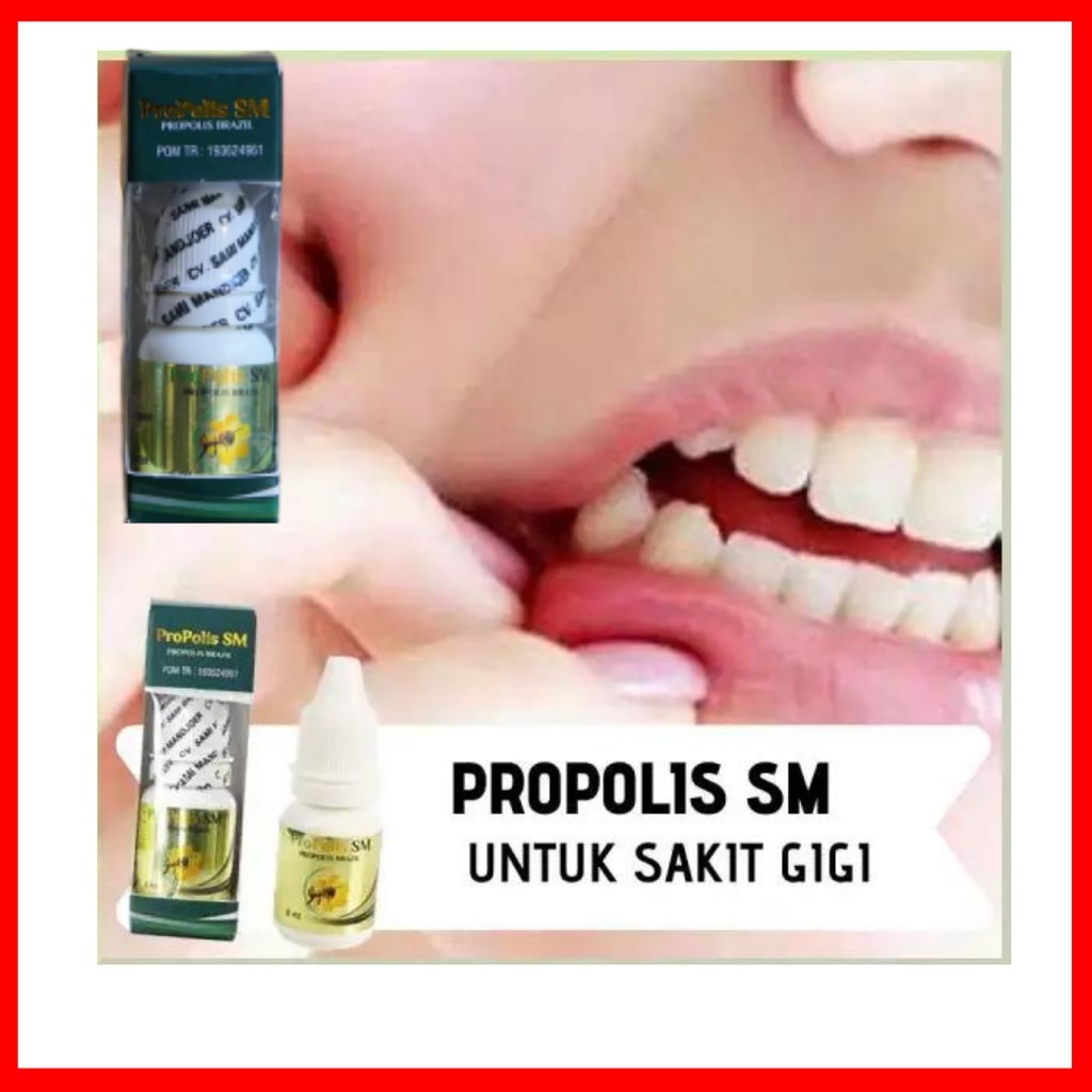Obat Sakit Gigi Berlubang, Pembersih Karang Gigi, Pembersih Gigi Berlubang - Propolis SM Original