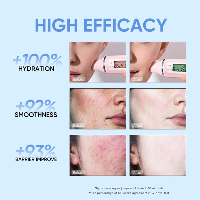 Skintific 4D Hyaluronic Acid Barrier Essence Toner / Acid Hydrating Serum