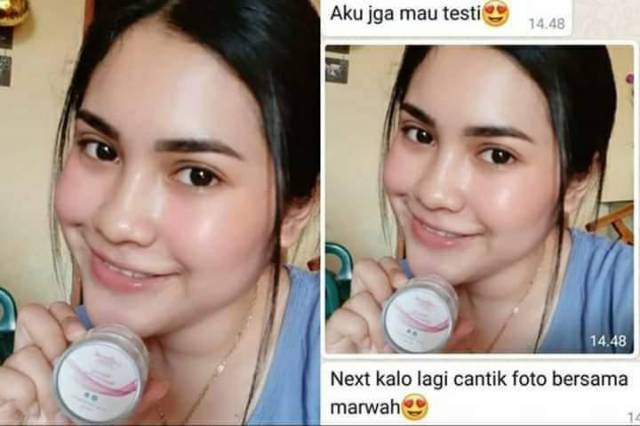 Diamond Acne Marwah Skincare HALAL &amp; BPOM