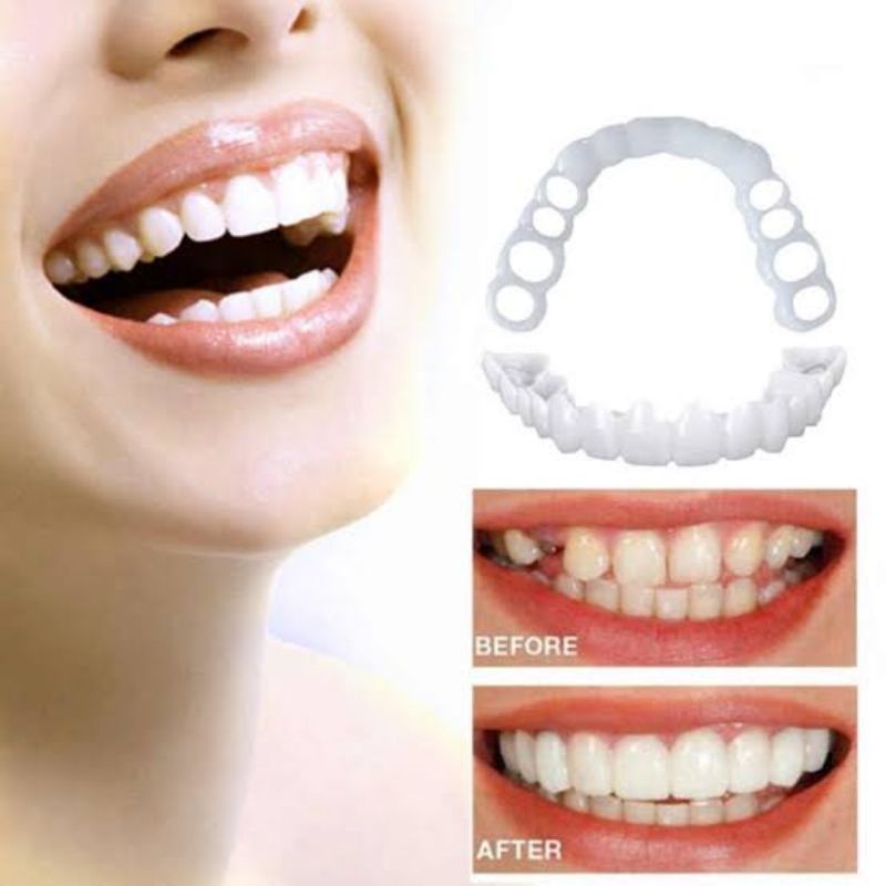 Snap On Smile Gigi Palsu Mainan | Set Atas Bawah Original 100% GROSIR dan ECER