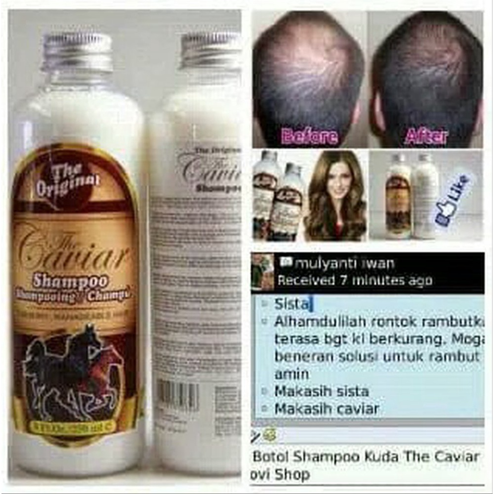 [ORI] SHAMPOO KUDA PENUMBUH RAMBUT BOTAK ATAU RONTOK AMPUH DALAM 2 MINGGU 200ml BPOM