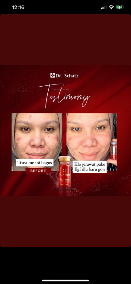 Dr Schatz GOJI Luminous Serum Lotion - Red Serum - SATUAN / ECER per vial - Missflolaks -serum wajah