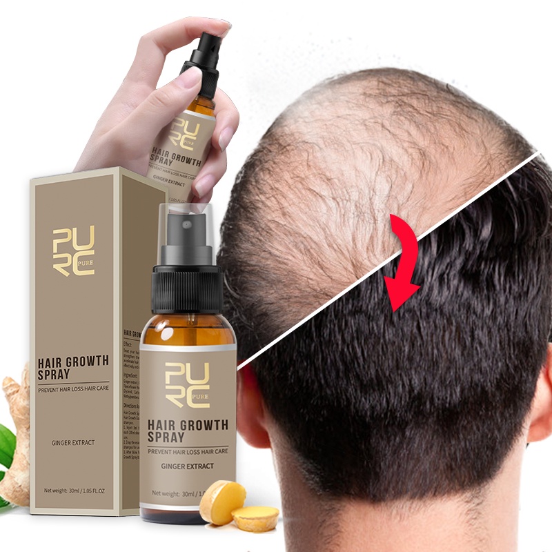 Produk Penumbuh Rambut Jahe Anti Rambut Rontok Serum Semprot Cepat Tumbuh Perawatan Minyak Esensial Rambut Kering Menipis Perawatan Kulit Kepala Keriting