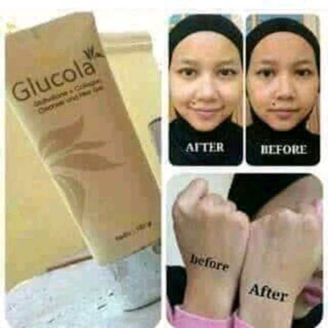 Glucola gel produk MCI