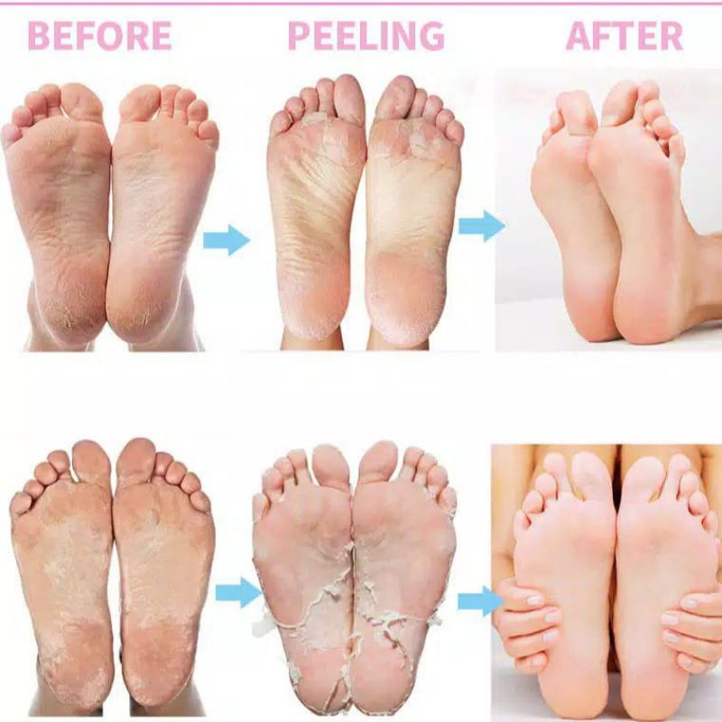 EFERO FOOT MASK LAVENDER (Masker Kaki 1Pasang)