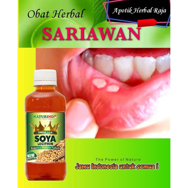 Jual Obat Sariawan Ampuh Panas Dalam Bibir Pecah Pecah Herbal Sariawan Shopee Indonesia