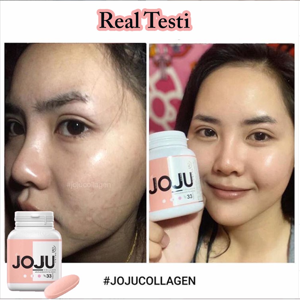 Pemutih Kulit Dan Jerawat Joju Collagen Prime Indonesia