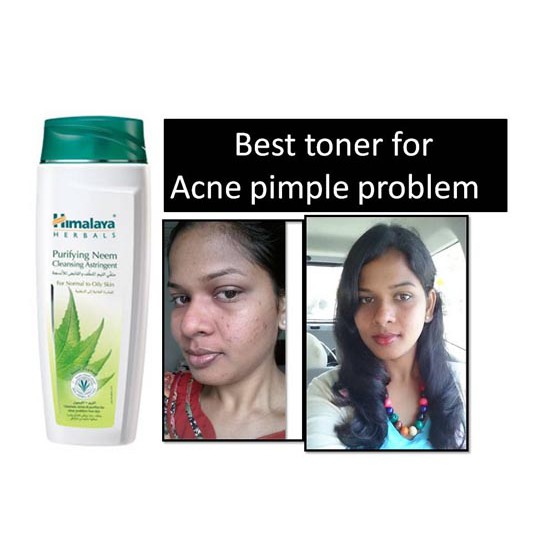 Himalaya Purifying Neem Cleansing Astrigent Toner_Neem Mask