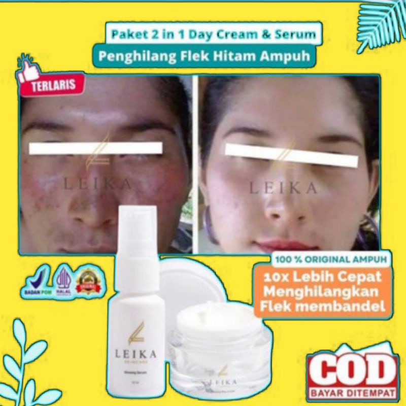 Paket 2in1 Ampuh permanen penghilang flek hitam di wajah penghilang flek hitam di wajah ampuh bpom k