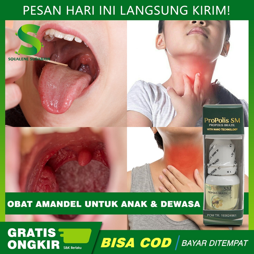 Obat Amandel Untuk Anak dan Dewasa - Amandel Sakit - Amandel Bengkak - Amandel Parah - Dengan Propol