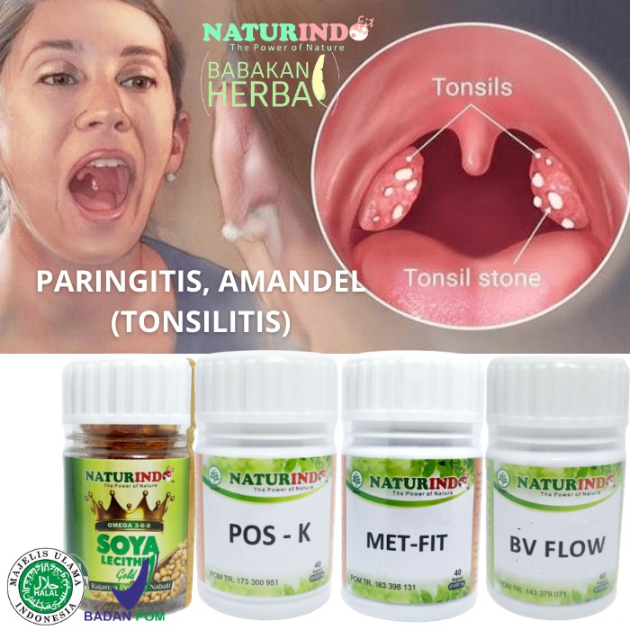 

Herbal Naturindo Amandel dan Radang Tenggorokan Obat Amandel Paling Ampuh