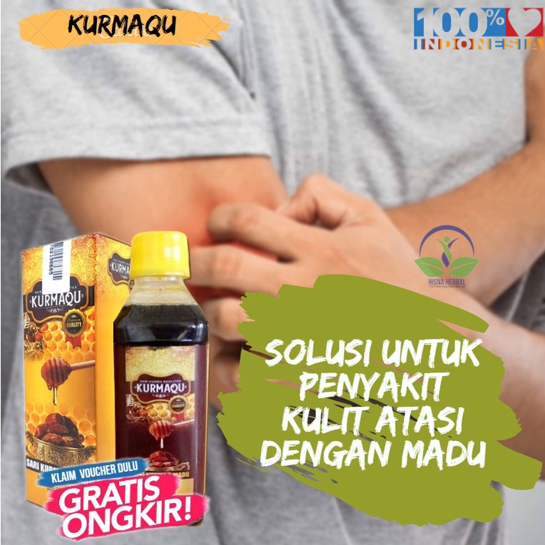 Obat Gatal Prurigo Yg Diminum, Solusi Penyakit Kulit Prurigo, Menghilangkan Prurigo Yang Di Minum, D