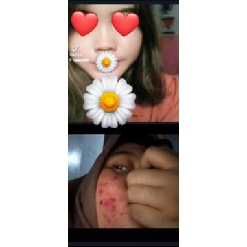 MG GLOW SKINCARE PAKET PEMUTIH WAJAH